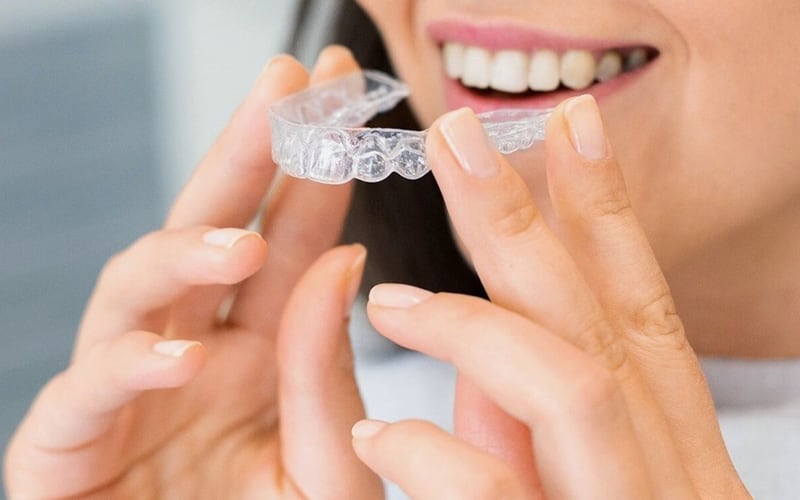 Alinhador transparente nas mãos de uma mulher, próximo ao sorriso