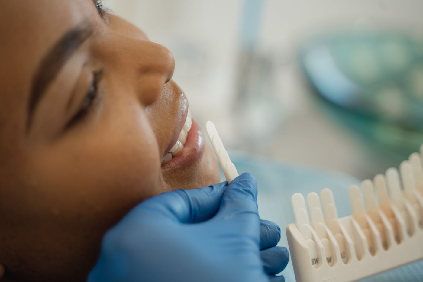 Seleção de cor dos dentes com escala de tonalidades